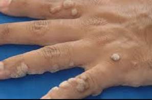 Περιγραφ: http://1.bp.blogspot.com/-ZiQDi9d9ODM/T_aAqDjHicI/AAAAAAAAO0o/HROeDHQadv8/s1600/tromaktiko.jpg