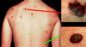 Περιγραφ: http://www.keme.eu/clients/avramidis/pictures/xartografisi-spilon.jpg