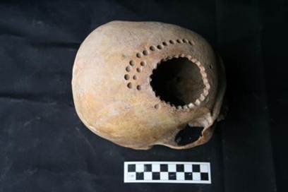 Ancient cranial surgery